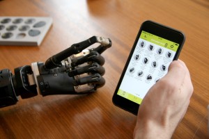 Bertolt Meyer kann mit seiner Prothese auch sein Handy bedienen. (Foto: dpa)