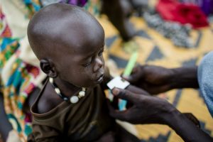 Im Südsudan sterben viele Kinder an Unterernährung. Deshalb versuchen auch hier Organisationen zu helfen. (Foto: Help/Simatis)