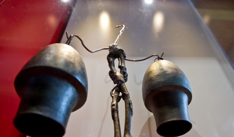 Was sind Schröpf-Köpfe?