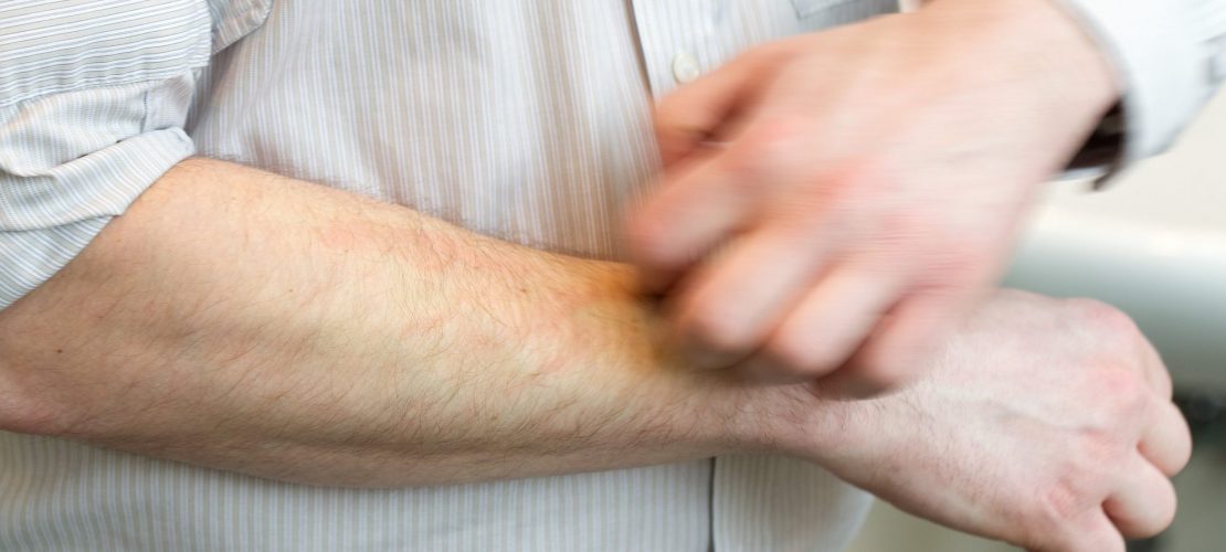 Ist Gähnen ansteckend?