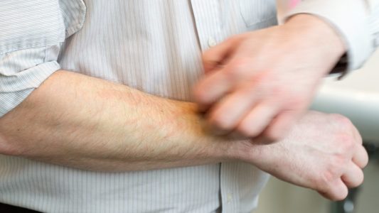 Ist Gähnen ansteckend?