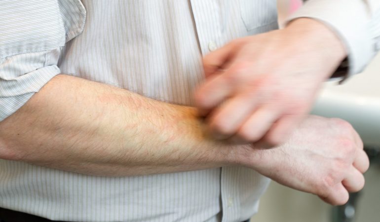 Ist Gähnen ansteckend?