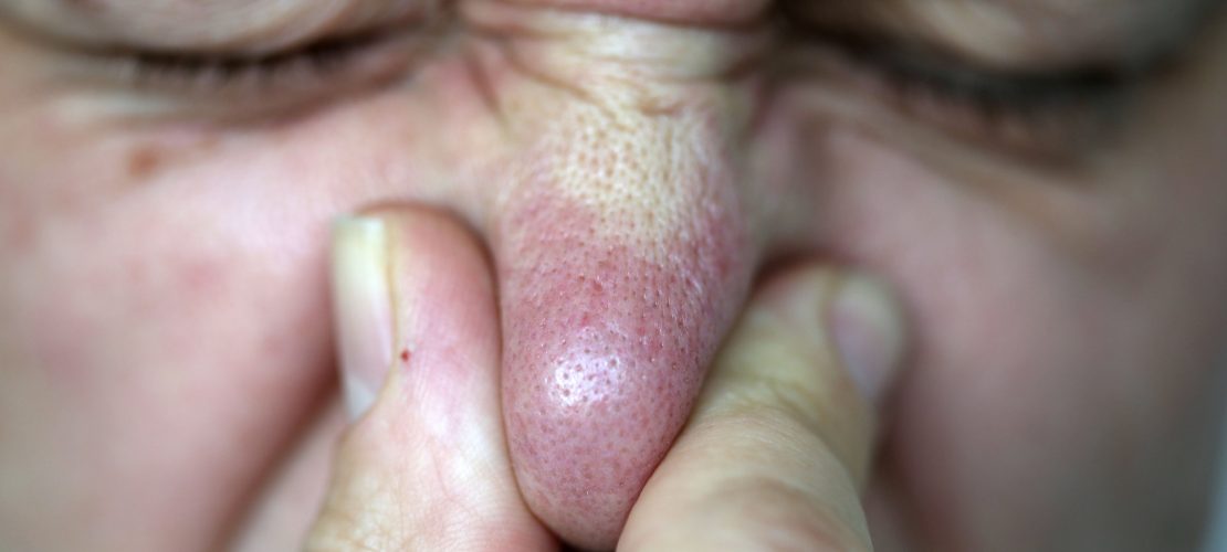 Warum riecht Pipi nach dem Spargelessen?