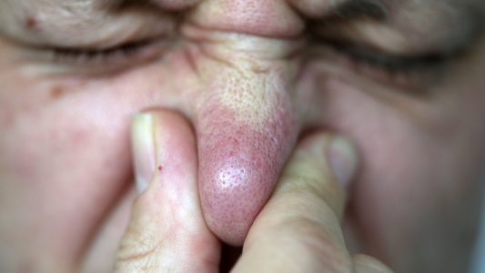 Warum riecht Pipi nach dem Spargelessen?