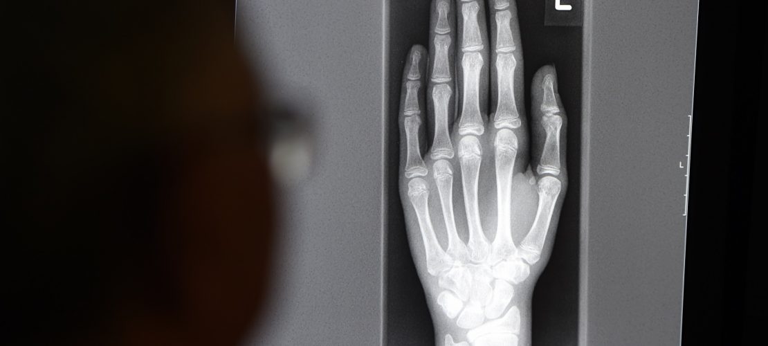 Wie kann man das Alter von Menschen erkennen?