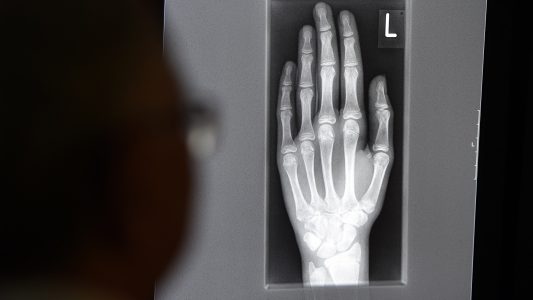 Wie kann man das Alter von Menschen erkennen?