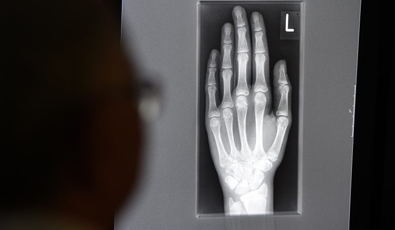 Wie kann man das Alter von Menschen erkennen?