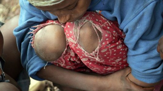 Mit großen Löchern in der Hose und zu kleinen Schuhen an den Füßen spielt dieses äthiopische Waisenkind am Sonntag (06.05.2007) im Stadtteil Sub-City Kirkos in Addis Abeba mit anderen Kindern. Laut Welthungerhilfe leben etwa 100.000 Straßenkinder in Addis Abeba. Foto: dpa