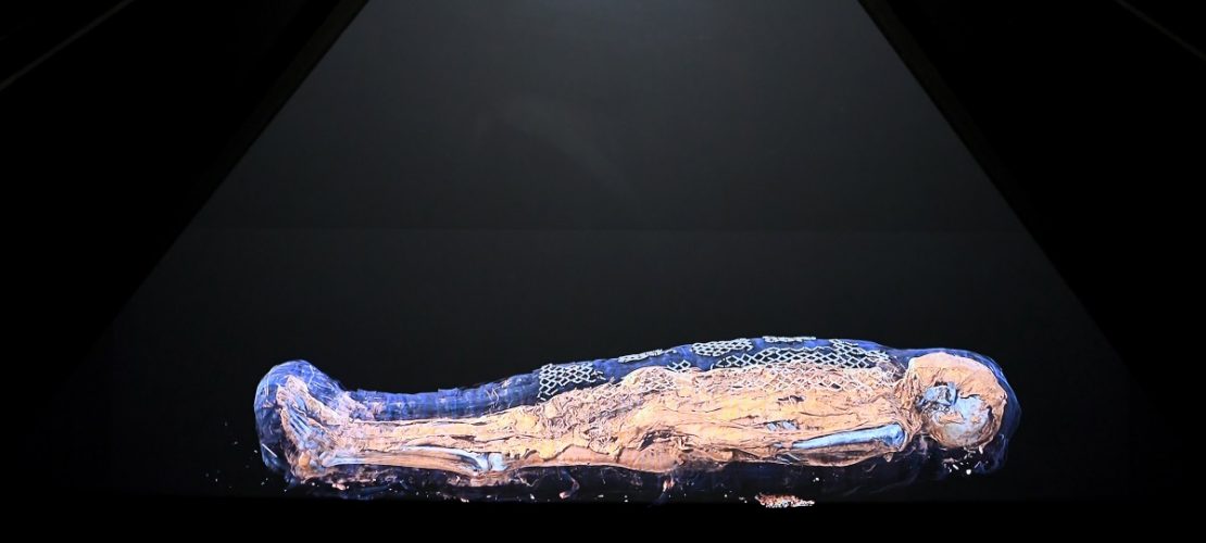 Die Frau Ta-cheru wurde in ein Krankenhaus gebracht und dort in eine besondere Röhre geschoben: den Computer-Tomografen.( Foto: dpa)