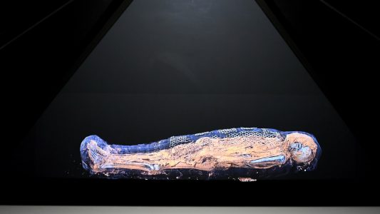 Die Frau Ta-cheru wurde in ein Krankenhaus gebracht und dort in eine besondere Röhre geschoben: den Computer-Tomografen.( Foto: dpa)