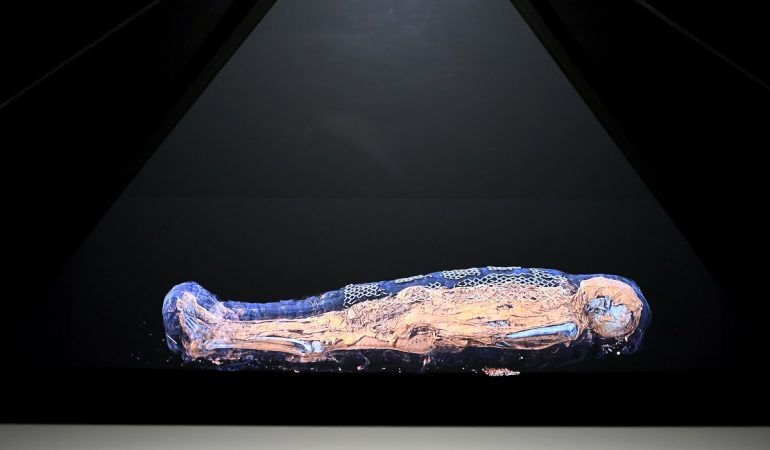 Die Frau Ta-cheru wurde in ein Krankenhaus gebracht und dort in eine besondere Röhre geschoben: den Computer-Tomografen.( Foto: dpa)