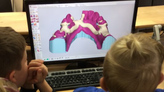 Zähne aus dem Drucker