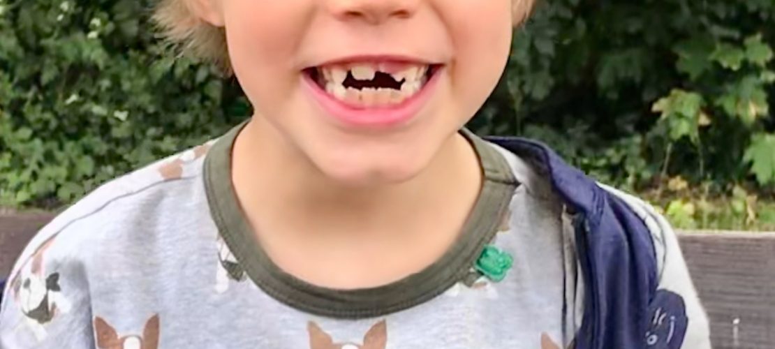 Tschüss, Milchzahn!