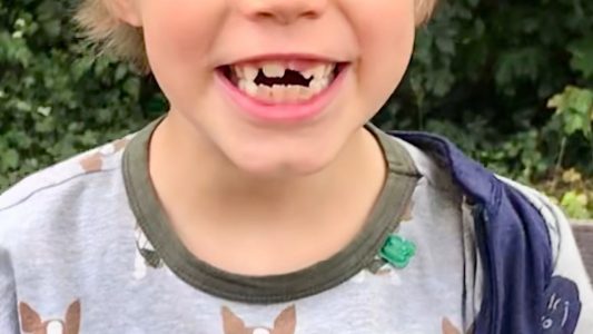 Tschüss, Milchzahn!