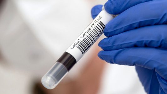 Kleine Probe, wichtiges Ergebnis