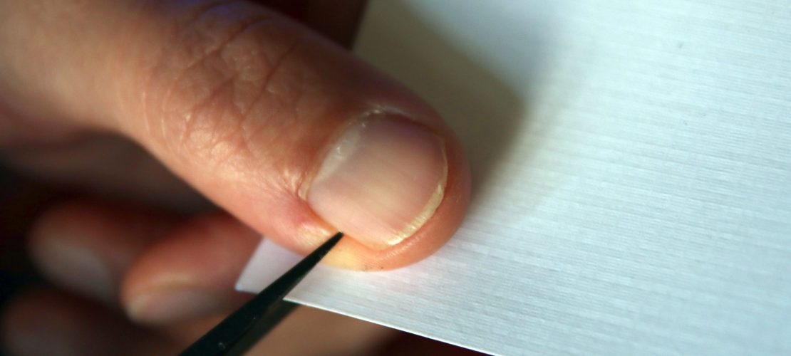 Gut, dass es weh tut