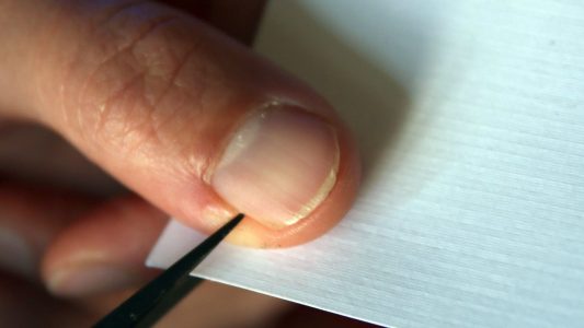 Gut, dass es weh tut